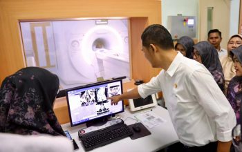 Sekda Aceh, M. Nasir, memeriksa hasil pemindaian dari alat MRI 1,5 Tesla usai prosesi serah terima di Gedung Onkologi RSUDZA, Banda Aceh, Rabu (8/10/2025).