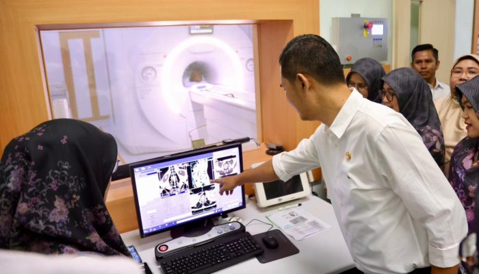 RSUDZA Kini Miliki MRI Tesla, Layanan Diagnostik Makin Cepat dan Akurat