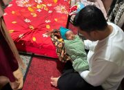 Haili Yoga Tanggung Operasi Bayi Bibir Sumbing