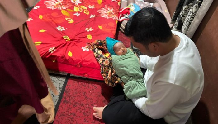 Haili Yoga Tanggung Operasi Bayi Bibir Sumbing