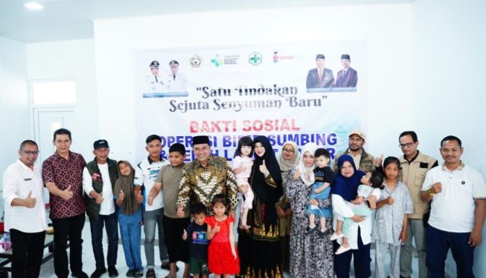 Wabup Aceh Tengah Buka Bakti Sosial Operasi Bibir Sumbing