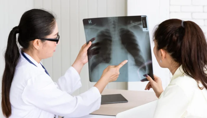 Kematian TBC 125 Ribu Setahun, Waspadai Batuk Dua Minggu