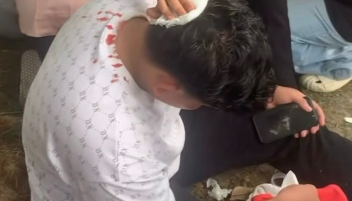 Mahasiswa UBBG Terluka Saat Aksi Tolak Pergub JKA